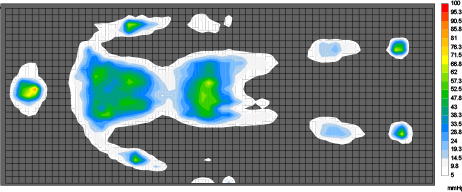 体圧分散測定結果